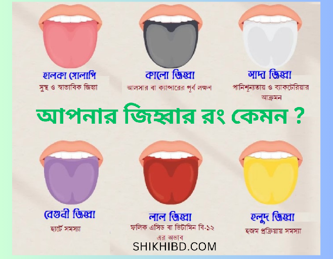 জিহ্বার রং দেখে রোগ নির্ণয় করুন